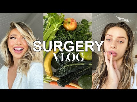 VLOG: Fixing my Smile, Gum Graft Surgery, Tips to Heal and Recover, Eating 30+ Fruits and Veggies