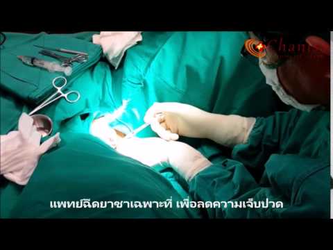 ประเภทของการผ่าตัดเต้านม 16 ฉันมีหน้าอกเล็กว่าจะทำอย่างไร
