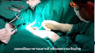 ผ่าตัดตกแต่งจุดซ่อนเร้นผู้หญิง ผ่าตัดตกแต่งจุดซ่อนเร้นผู้หญิง