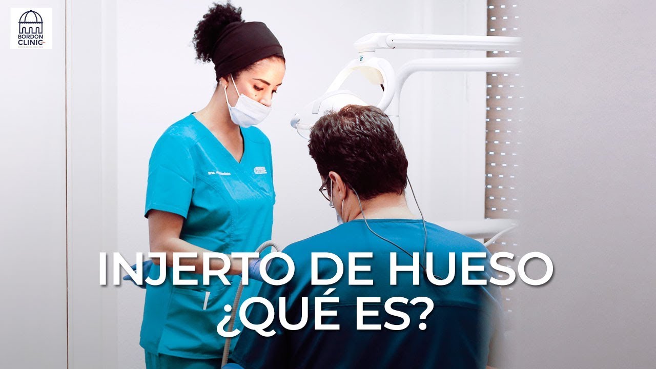 Watch ¿Qué es un injerto de hueso y en qué consiste Now ¿Qué es un injerto de hueso y en qué consiste