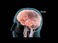 Stroke What Happens Inside Your Brain 3D Medical Animation Breakdown