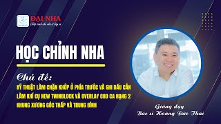 Kỹ thuật làm chặn khớp ở phía trước và ghi dấu cắn làm khí cụ New Twinblock và Overlay cho ca hạng 2