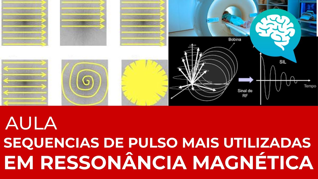SEQUENCIAS BASICAS E AVANÇADAS DE RESSONÂNCIA MAGNÉTICA - PAPOTEC - WALLACE