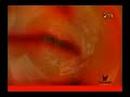 NAPALM DEATH   Necessary Evil Official Video