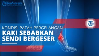 Ankle Fracture, Kondisi Tulang Sekitar Pergelangan Retak dan Mengakibatkan Sendi Bergeser