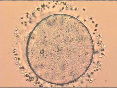 IVF Sperm trying to penetrate an egg