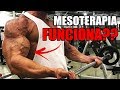 O SEGREDO DO BÍCEPS | MESOTERAPIA FUNCIONA?