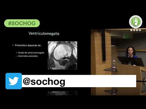 Reunión Clínica Sochog – Junio 2018