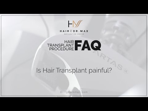 FAQ: "Is Hair Transplant Painful?" - Hair By Dr. Max, Restoration Center
