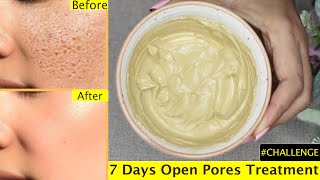 I applied this on open pores rough skin and results are shocking - I got smooth glass skin in 7 Days