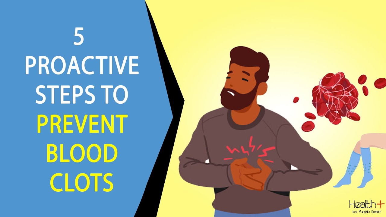 5 Proactive Steps to Prevent Blood Clots