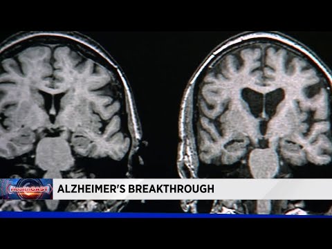 Doctors one step closer to finding cure for Alzheimer's disease