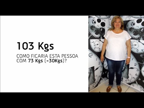 Como ficaria esta pessoa com - 30 kg ?