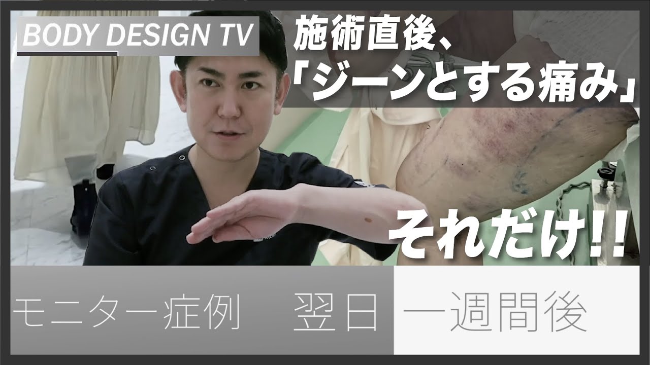 「電車で帰ります！」施術直後から普通に身体が動く！