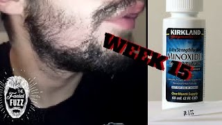 Minoxidil Beard | Week 15 | The Experiment | #FacialFuzzFridays