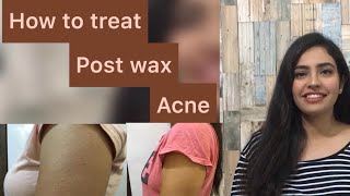 How To  Treat ACNE/BUMPS/REDNESS after wax (Postwax acne treatment) | POOJA DHEMBLA