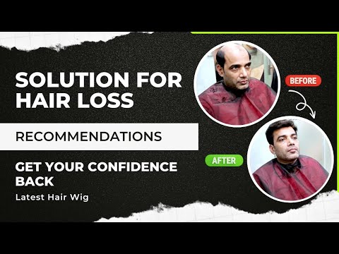 Men baldness solution, for personal