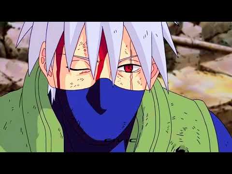 Pain really dared to say "know pain" to kakashi! 🤧