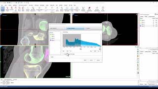 Tutorial: Introduction to the CT Bone Wizard