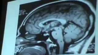 Dr Ayman Abo-Eleinen X-ray 29-4-2014