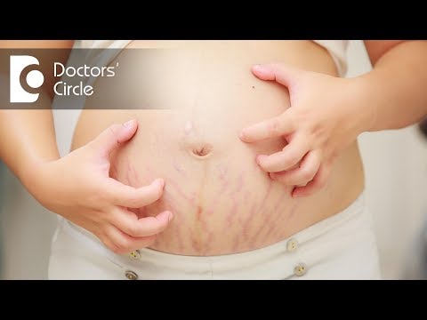 How to manage pregnancy rashes? - Dr. Tina Ramachander