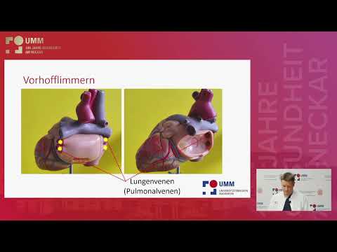 Vorhofflimmern: Häufig, aber gut zu behandeln