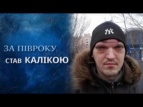Из красавца в чудовище (полный выпуск) | Говорить Україна
