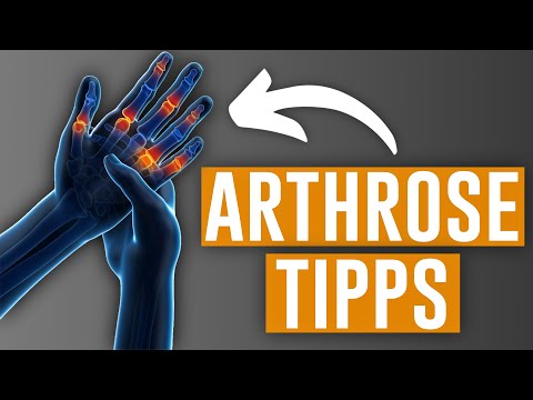 Hilfe bei Arthrose in den Fingern! (Auch Daumen)