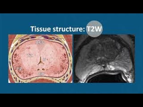 Prostatitis gyertyák összetétele