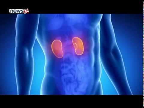 अबैद्य मृर्गौला प्रत्यारोपण गर्ने निधान अस्पतालका पाँच जना कारागार चलान - NEWS24 TV