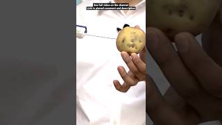 Download lagu How a biopsy for cancer diagnosis is done | With help of potato | Dr. Gaurav Gangwani mp3
