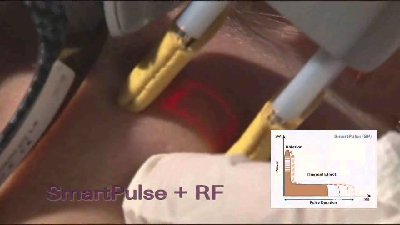 YouTube Video Preview