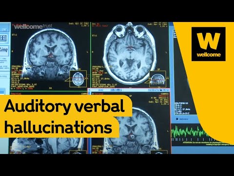 Hearing voices with Professor Charles Fernyhough | Wellcome