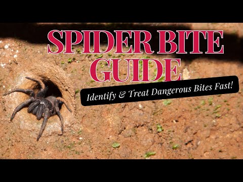 Spider Bite Guide: Identify & Treat Dangerous Bites Fast!