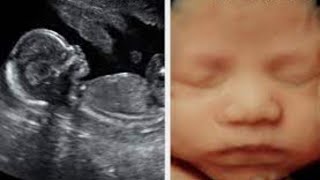 Watch the adorable 4D Ultrasound video of a baby girl