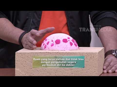 Diet sehat tidak untuk menurunkan berat badan Menurunkan berat badan dari 60 kg ke 49