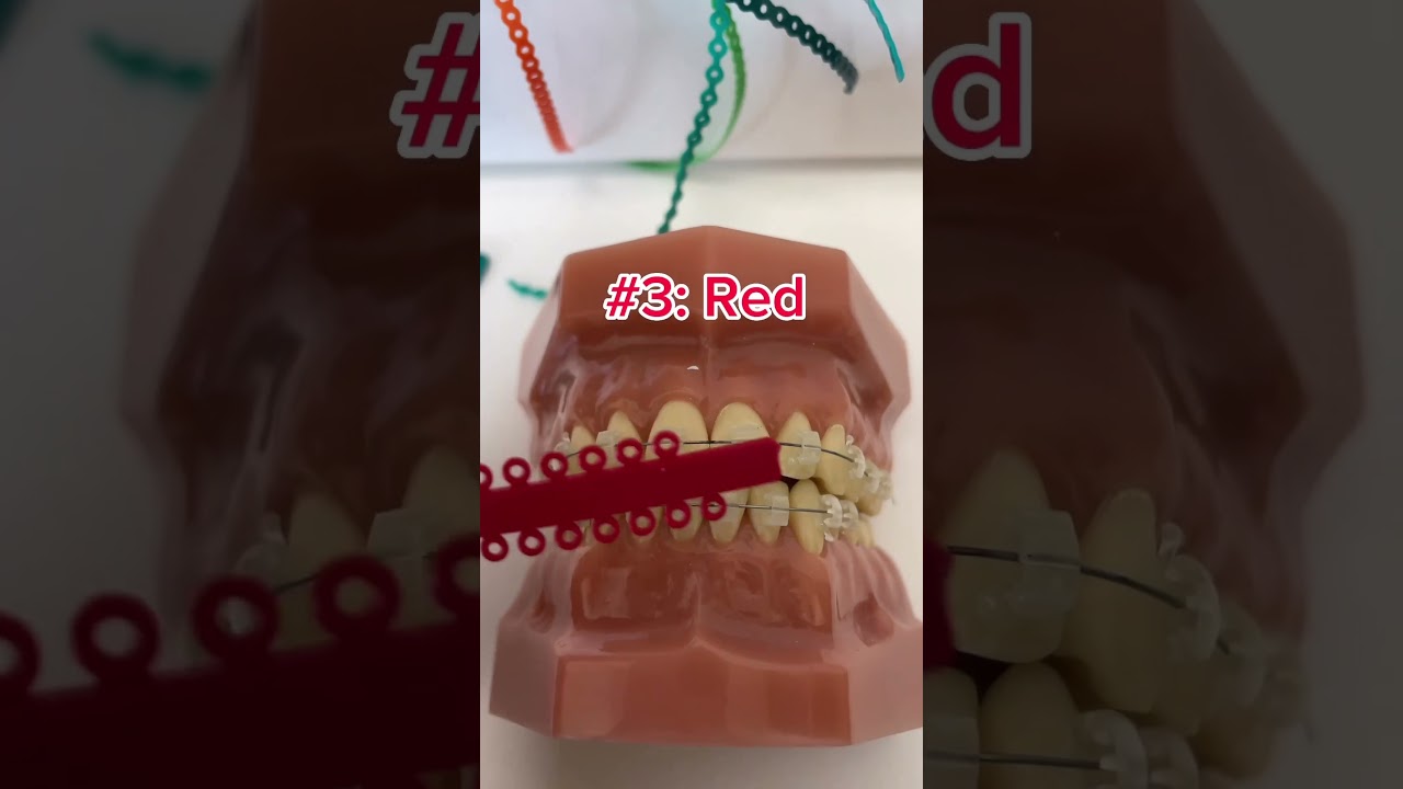 Braces colors that'll make you teeth look...👀🦷✨