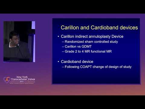 Current and Future Trials of Transcatheter Mitral Valve Replacement full