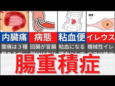 腸重積について詳しく解説
