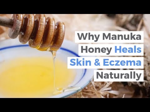 , title : 'Why Manuka Honey Heals Eczema, Psoriasis, & Wounds | The Best Natural Cream for Eczema'