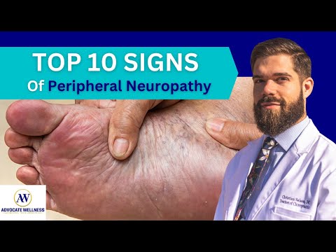 TOP 10 SIGNS of Peripheral Neuropathy (Bonus at End)