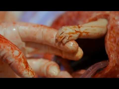 download lagu mp3 mp4 Medicine Status For Whatsapp, download lagu Medicine Status For Whatsapp gratis, unduh video klip Medicine Status For Whatsapp