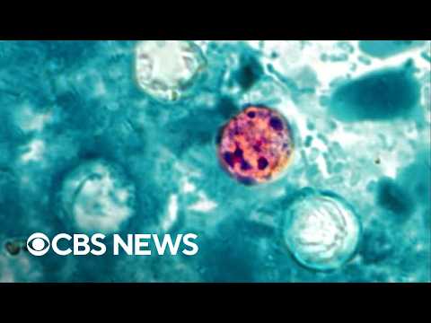 What to know about cyclosporiasis' lethality after Michigan reports 2 deaths