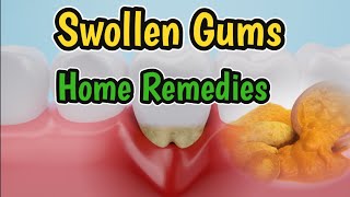 Swollen Gums Home Remedies | Tips To Reduce Swollen Gums At Home |