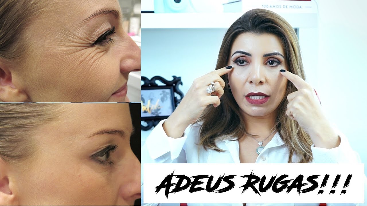 Adeus Rugas!! Prolongando o efeito do Botox