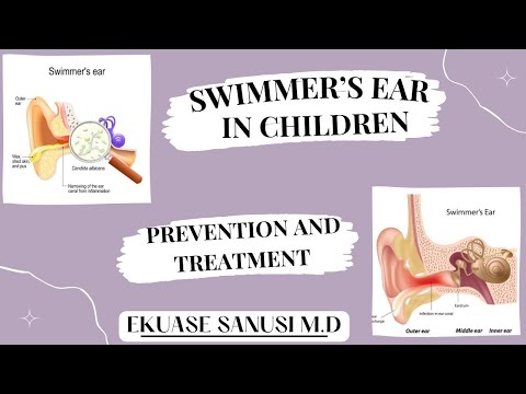 How To Protect Your Child From Swimmer's Ear Infection | Ekuase Sanusi M.D. | Pediatrics To Go