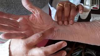 Ayurvedic Pulse Reading (2)