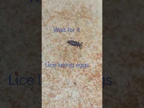 Lice removal | live lice egg laying | gross 🤢 | subscribe for more