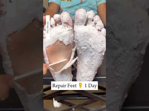Repair Cracked Heels In 1Day | Get Rid Of Dry Feet | Get Fair & Soft Feet Instantly #cracked #shorts