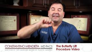 Miami Butterfly Lift -- Dr. Mendieta
